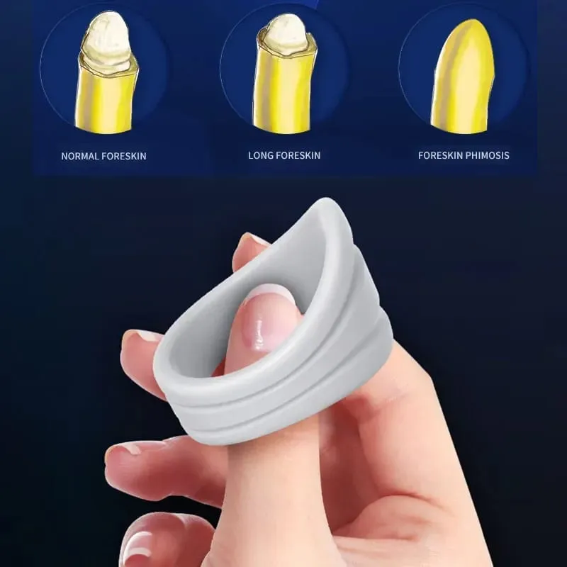 Männer Cock Ring Penis Vorhaut Korrektur Cockring Wiederverwendbare Penis Sleeve Verzögerung Ejakulation Keuschheit Käfig Sex Spielzeug für Männer Paare — image 5