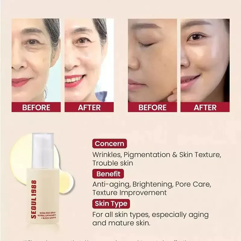 เซรั่ม 1988 : Retinal Liposome 2% + Black Gingeng 30ml/1.01fl.oz | สารสกัดจากโสมดำ 58% พร้อมเรตินอล บาคุชิล ไวต้า — image 6