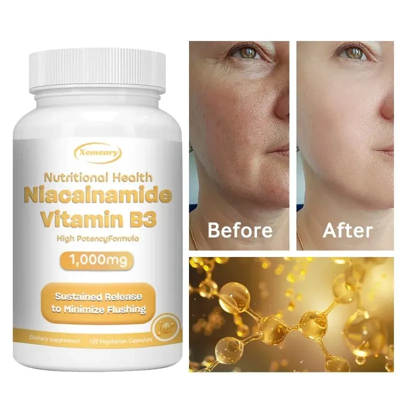 Capsules de niacinamide vitamine B3 – Soutient la fonction cérébrale et la santé cardiaque, stimule la production d'énergie et améliore l'immunité. — image 1