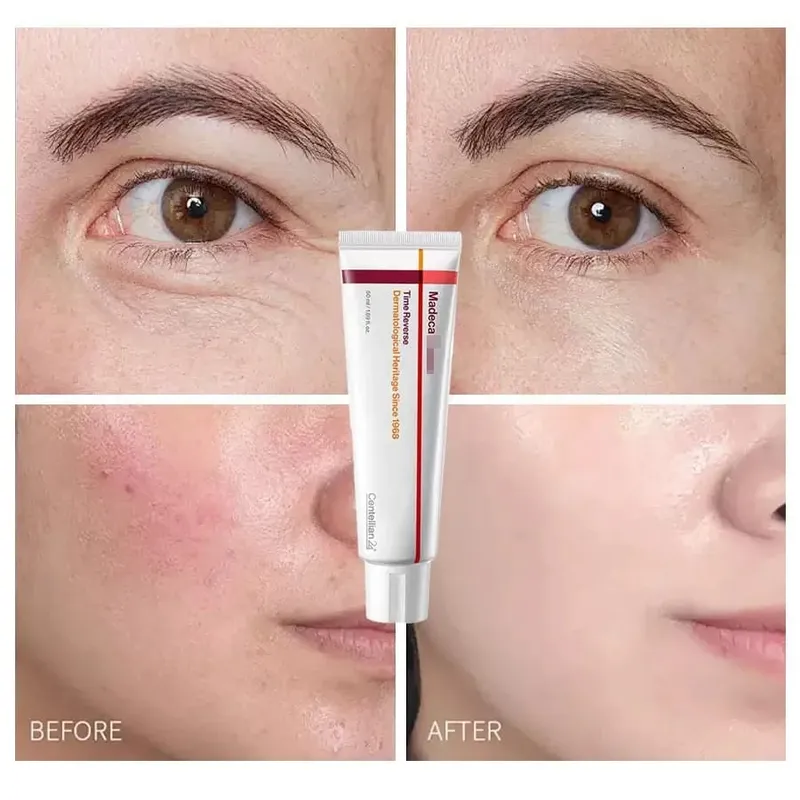 Collagen Madeca Cream Time Reverse Advanced Fast-Absorbing Nourishing Hydrates Firms Reduces Wrinkles Korean Skin Care Centella — image 5