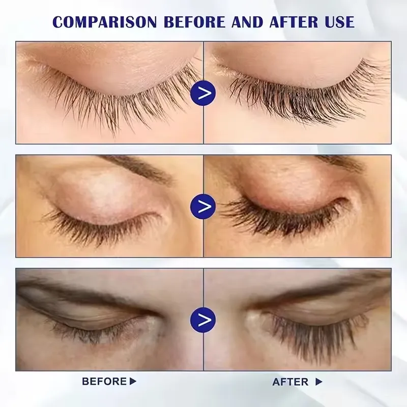 Snelle Wimpergroei Serum 7 Dagen Natuurlijke Wimper Wenkbrauw Enhancer Langer Voller Dikkere Wimpers Behandelingsproducten Oogzorg Make-up